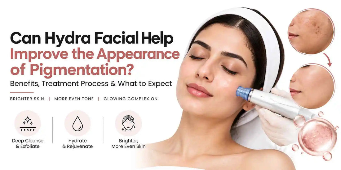 Can Hydra Facial Help Improve the Appearance of Pigmentation?
